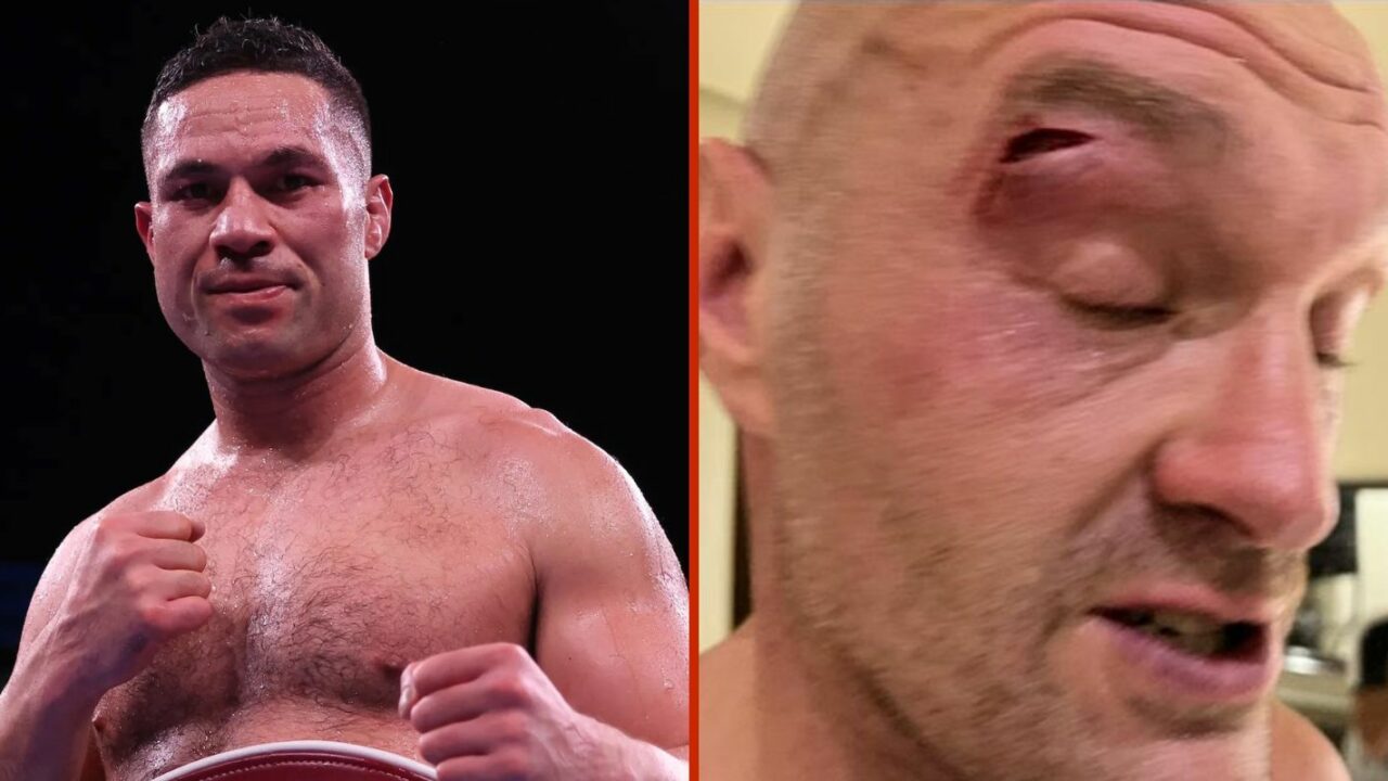 Joseph Parker Reacts To Tyson Fury Conspiracy Theories Over Cut